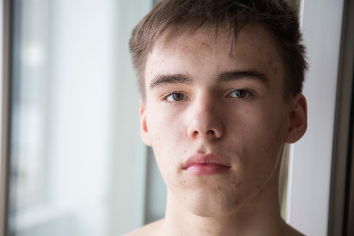 Quit Smoking Weed young man in clinical setting attempting to quit smoking weed