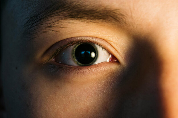 Face with large dilated pupils caused by drugs